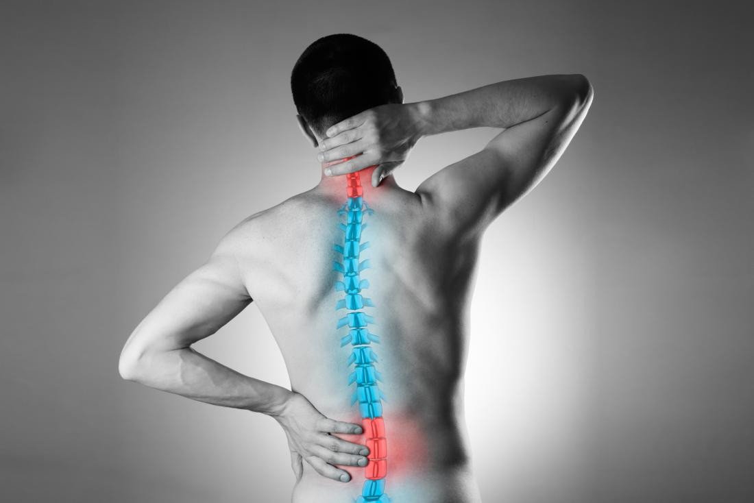 Spine Pain physiothearpy